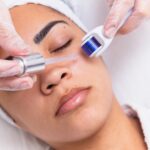 Curso de Microagulhamento e Peeling Químico em Goiânia
